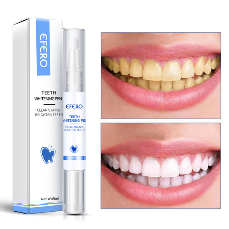Smiley Teeth Whitening (Promotion)