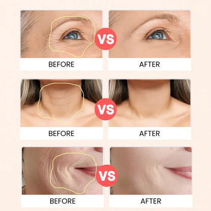 Skinévo Firming Solution for Smoother, Healthier Skin