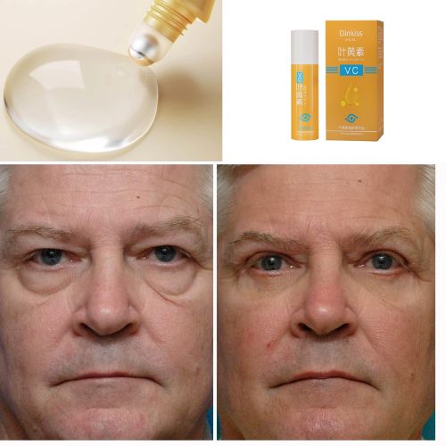 RevitaRoll 5-in-1 Ultra Rejuvenating Roller
